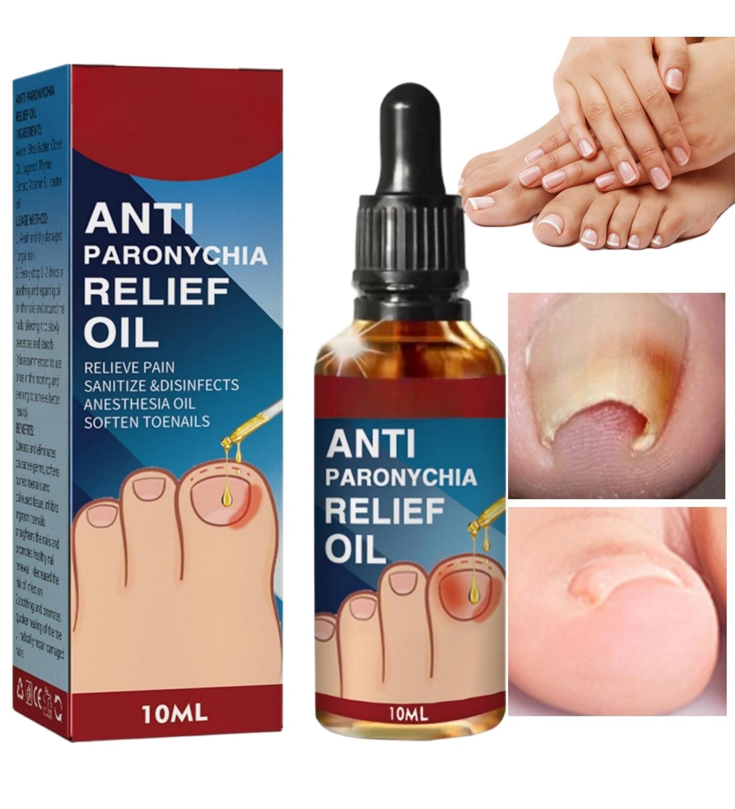 Ingrown Toenail Treatment and Removal Relief Oil - Nail Growth and Fungal Corrector - Buy Online on SooperMarket.com