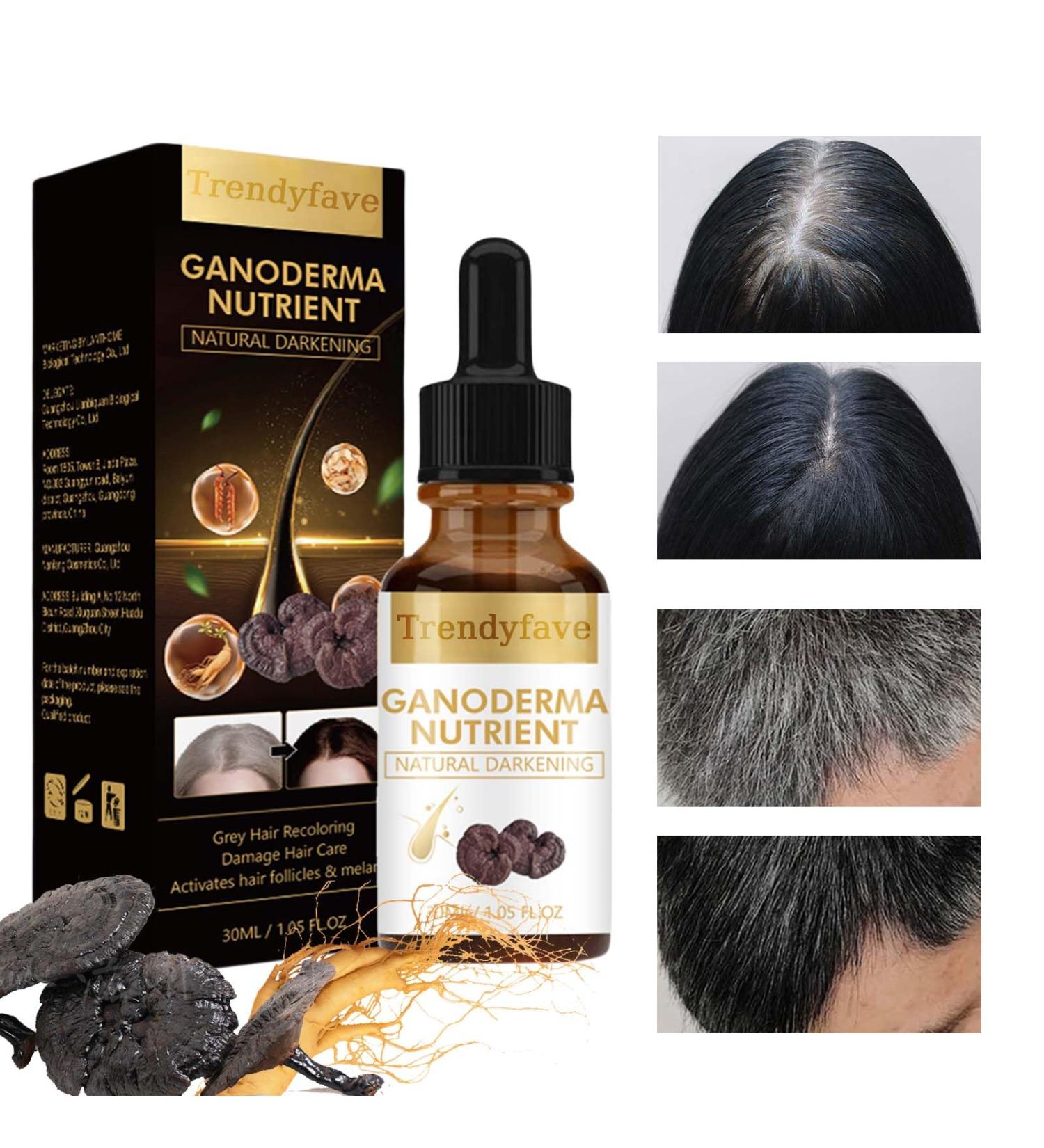 Trendyfave Anti-greying Hair Serum Ganoderma Nutrient Hair Darkening Serum Natural Hair Grey Reverse Essence Restore Hair Natural Color Grey Hair Coverage Serum Promotes Thicker Fuller Healthier Hair - Buy Online on SooperMarket.com