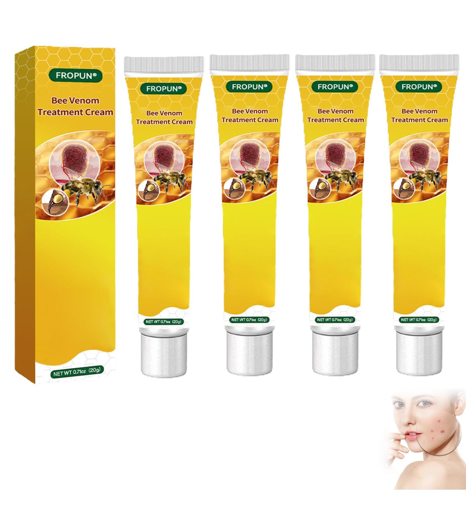 FROPUN Bee Venom Treatment Cream | Acne & Skin Repair | Hydrating Cream for Men & Women | 1 Fl Oz - Buy Online on SooperMarket.com