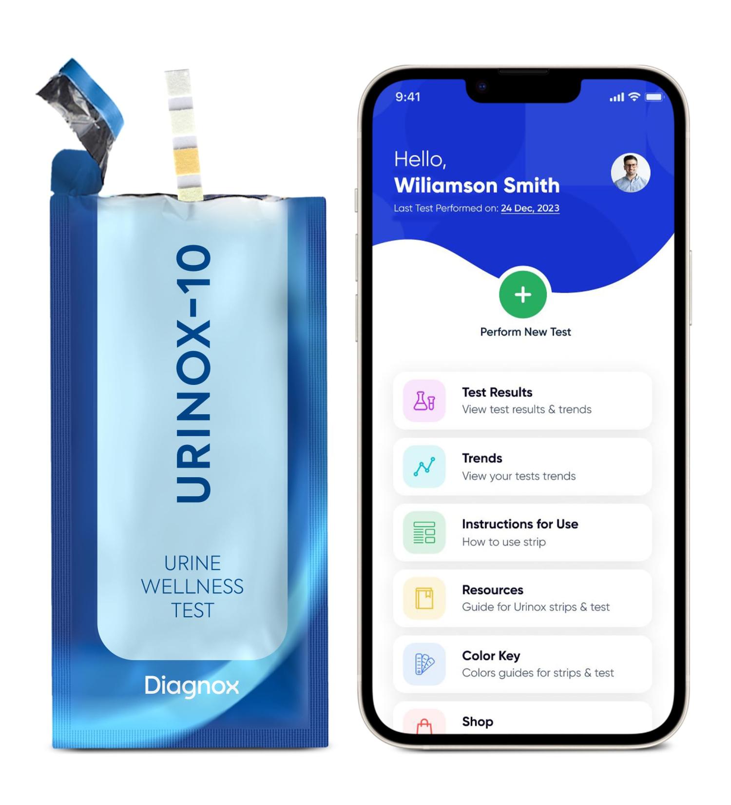 URINOX Urine Wellness Test Kit (30 Tests)