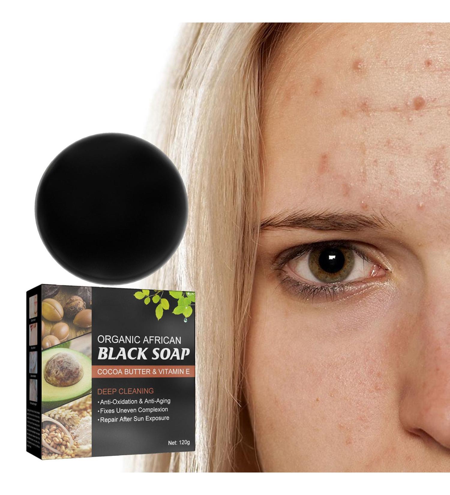 Nmbol Skin Acne Soap Soap for Removal of Black Spots ening Soap for Dark Skin Natural Soap Face Body Fixed Facial Cleaning Vegan For All Skin Types - Buy Online on SooperMarket.com