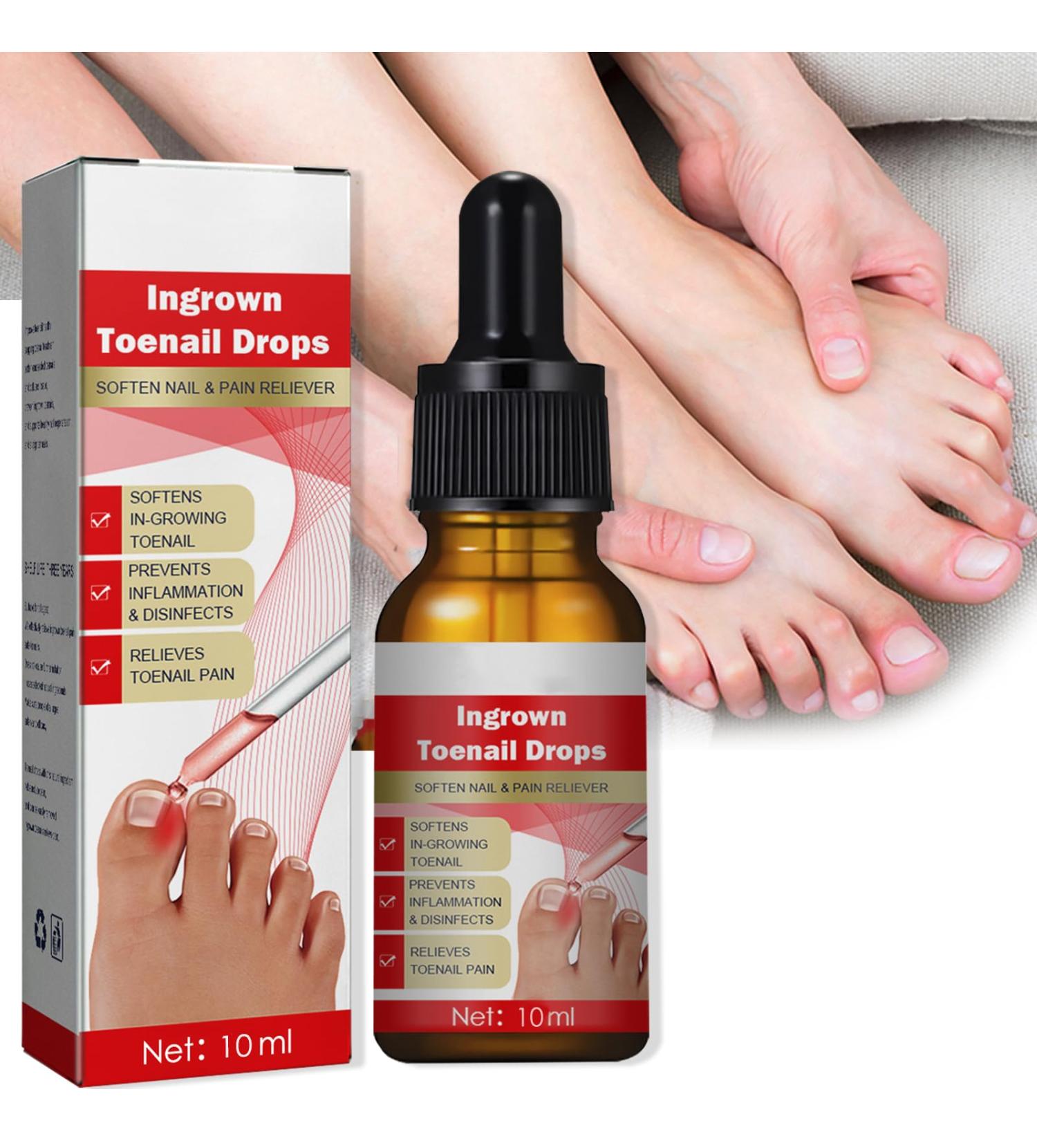 Ingrown Toenail Treatment Nail Growth Ingrowing Toenail Treatment Nail Helper Fungal Nail Treatment Correction Oil Drops Ingrown Toenail Corrector Toe Nail Fungus Treatment Cuticle Oil - Buy Online on SooperMarket.com