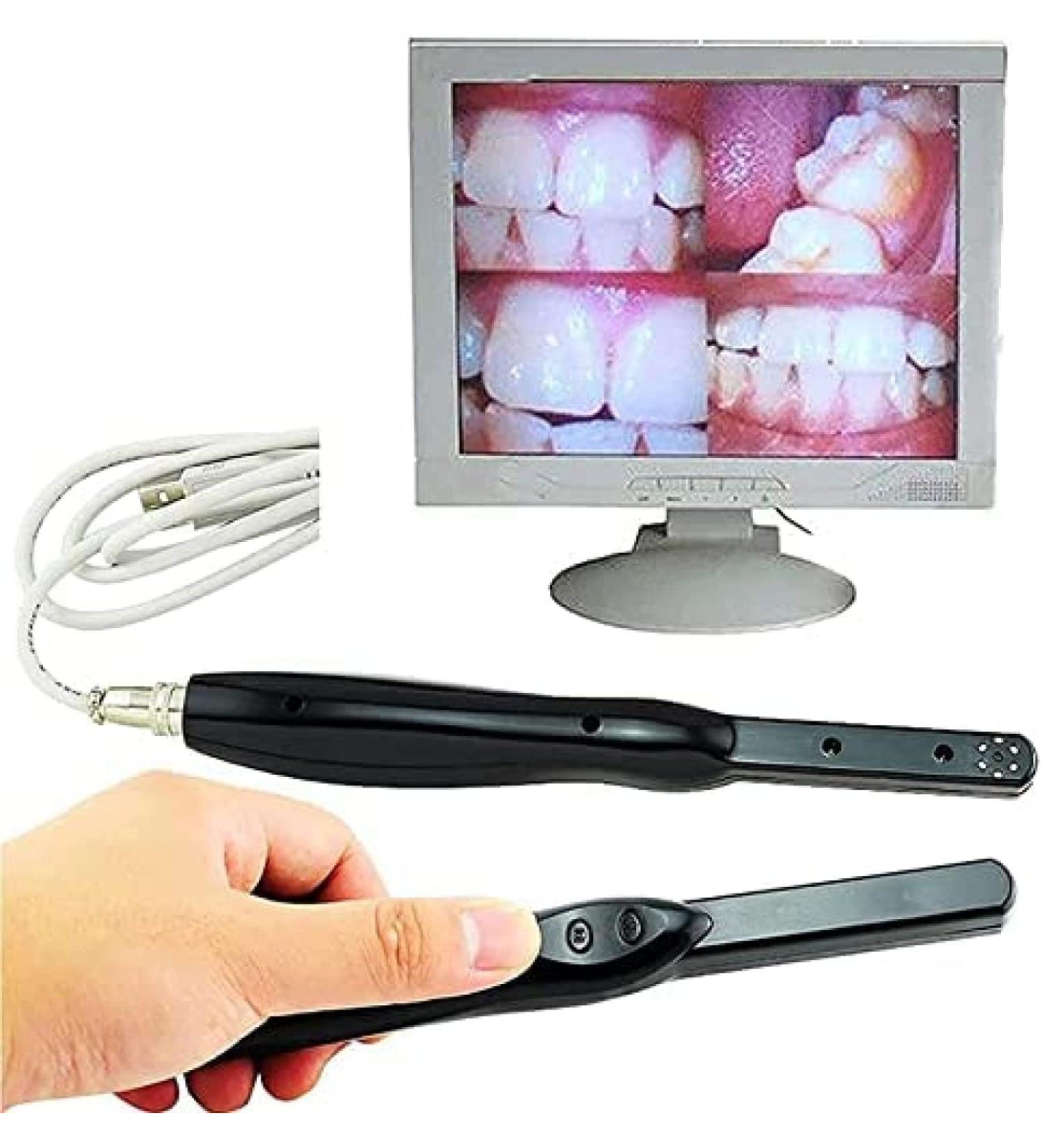 Buy HD Wireless Dental Intraoral Camera - 6MP 6 LED Clear Image for Pet & Human Oral Exams - Buy Online on SooperMarket.com