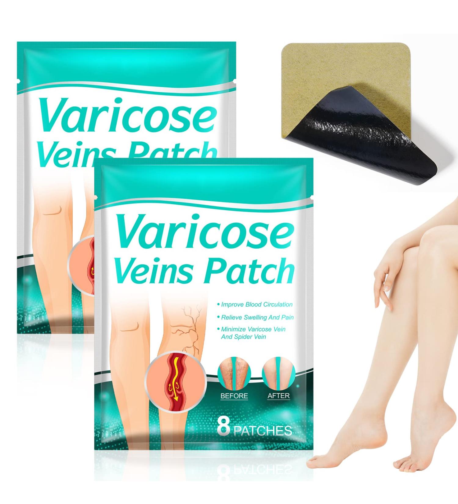 Fengyang 16Pcs Varicose Veins Treatment Patch Set for Legs - Spider Vein Relief, Soothes Leg Fatigue - Buy Online on SooperMarket.com