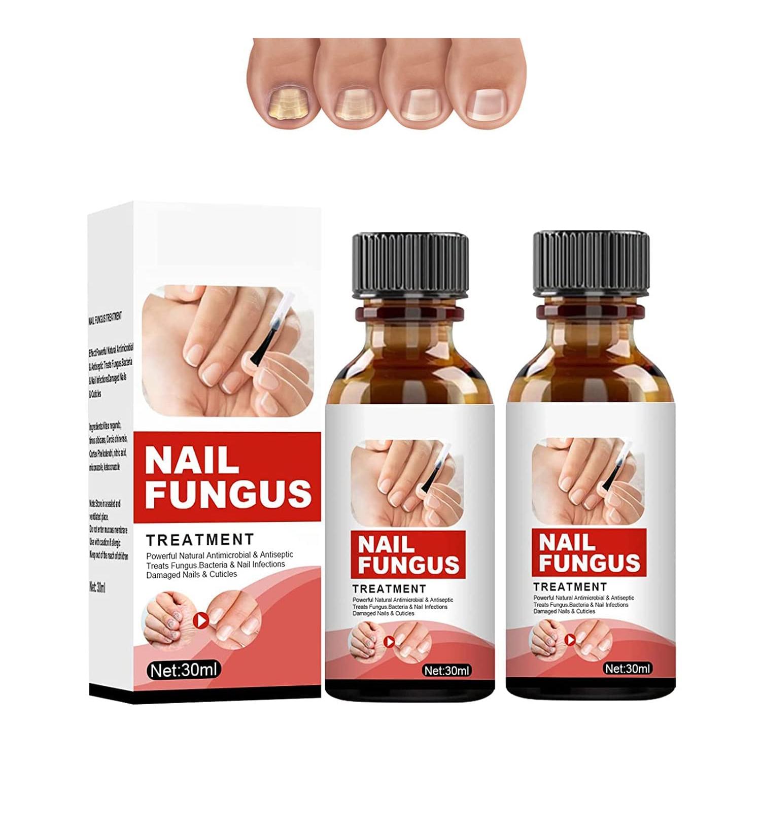 Buy Tlopa Nail Growth and Strengthening Serum - Nail Repair Solution (2 Pieces) for Stronger Healthier Nails Worldwide - Buy Online on SooperMarket.com