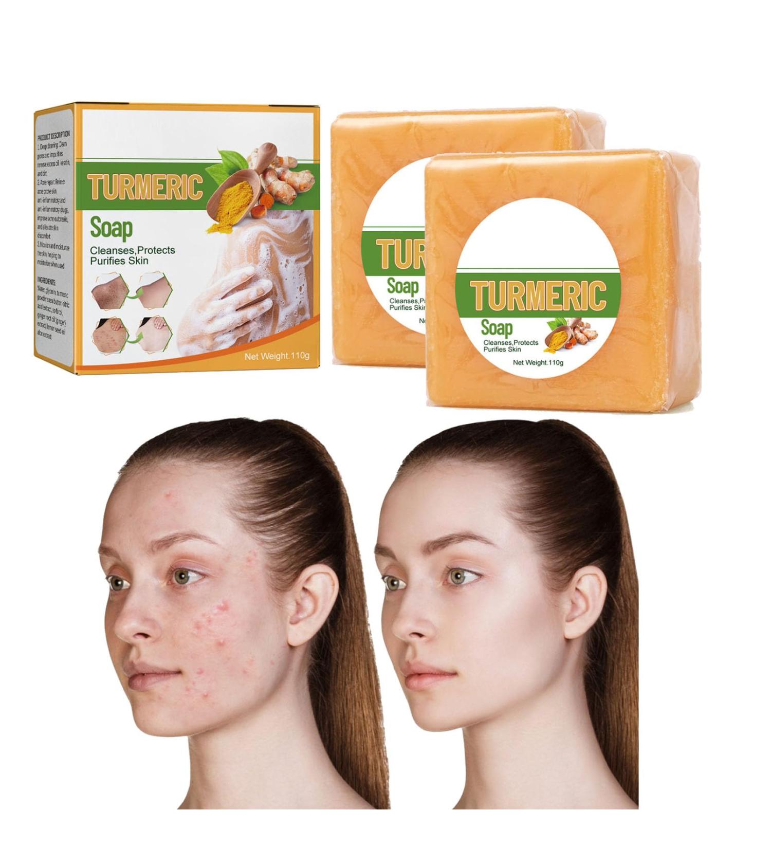 Nmbol Soap Cleansing Kojic Acid 3 - Buy Online on SooperMarket.com