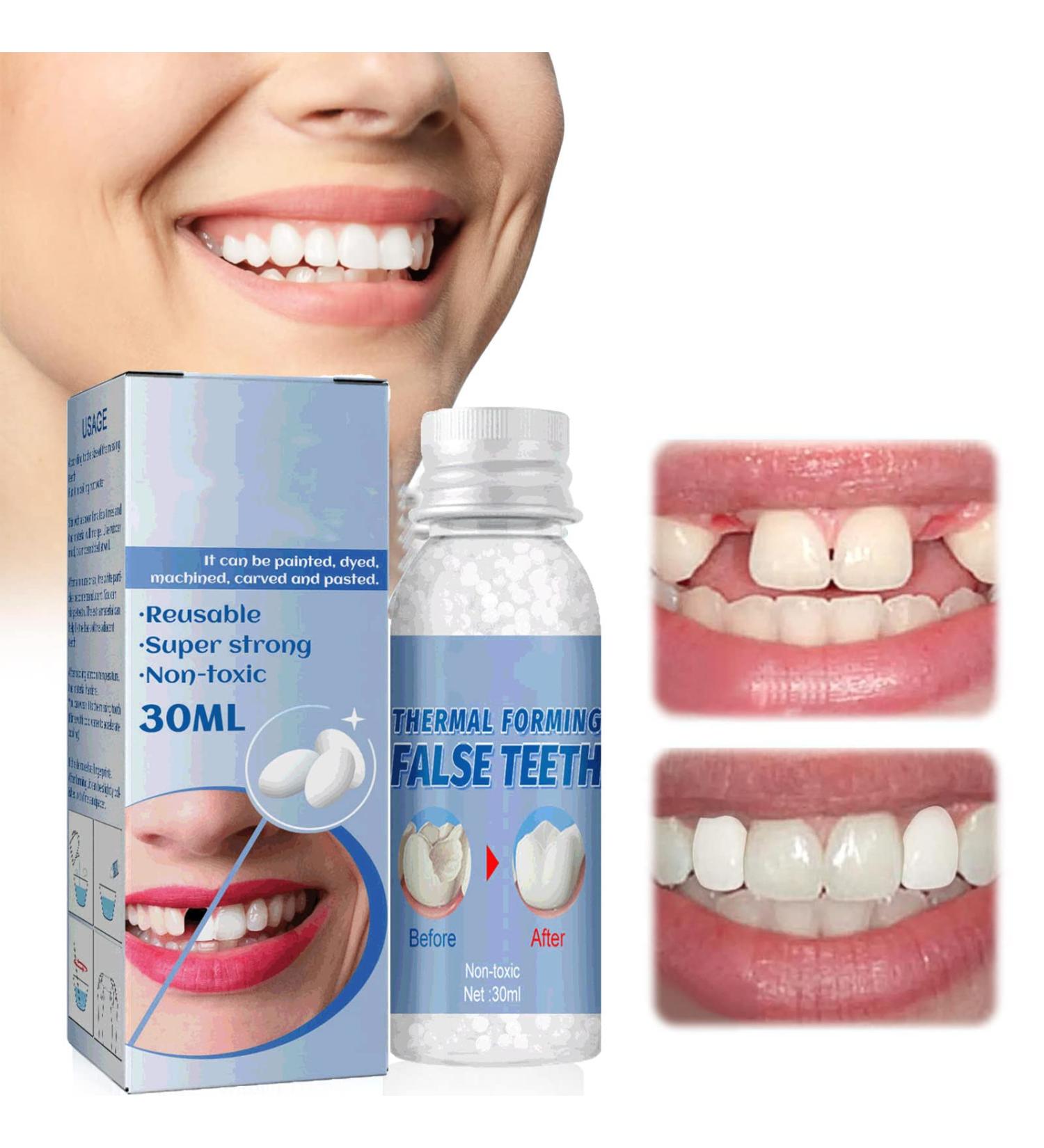 Flipped Warmth Tooth Repair Adhesive 60g Fix Missing & Broken Teeth Ideal for Prosthetics - Buy Online on SooperMarket.com