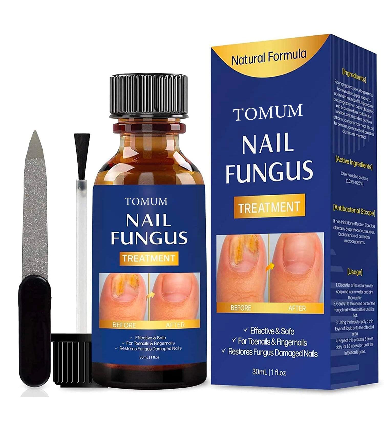 Extra Strength Toe Nail Fungus Treatment for Healthy Nails - Nail Repair Solution - Buy Online on SooperMarket.com