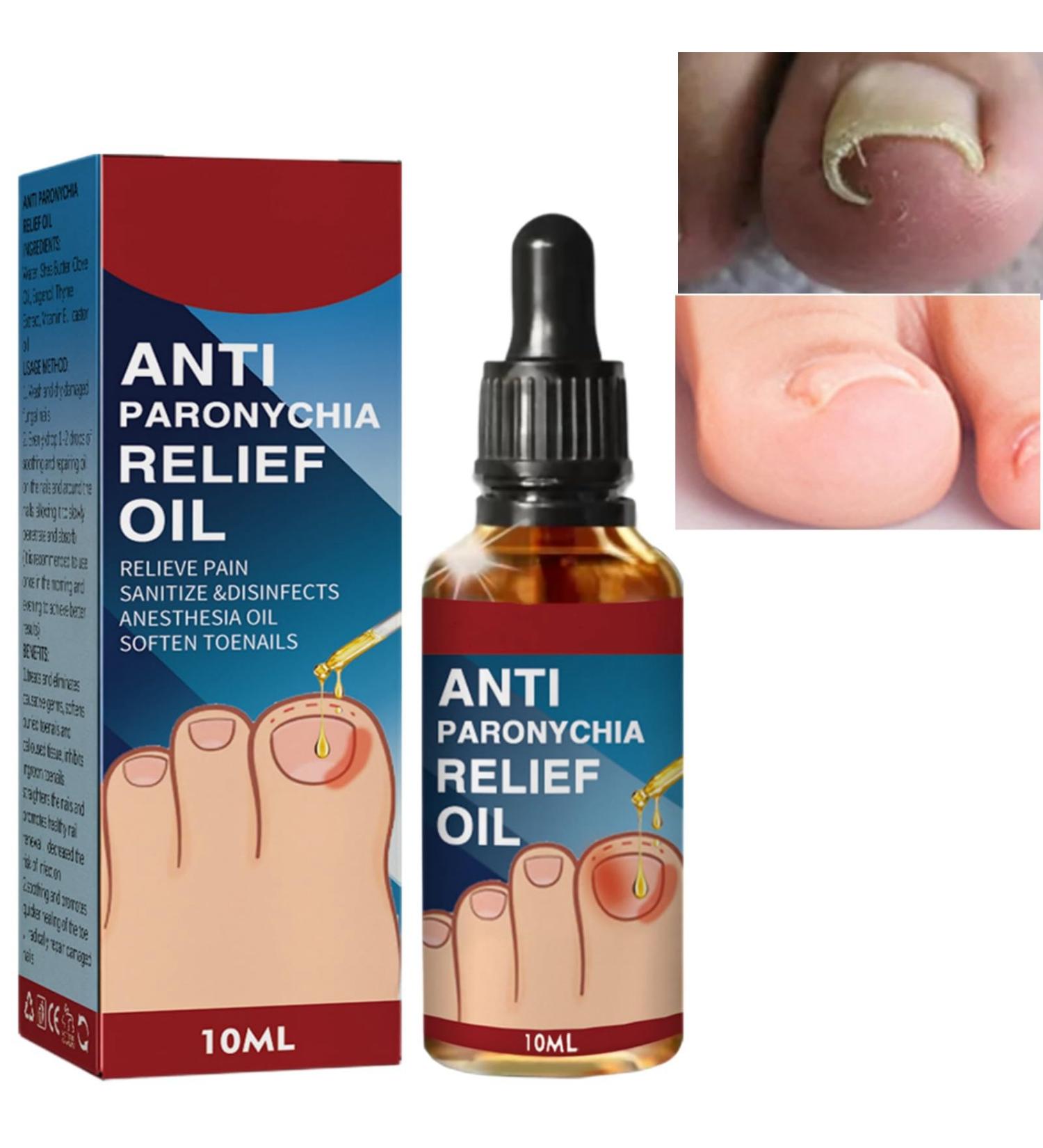 Ingrown Toenail Treatment Correction Drops Nail Growth Treatment Nail Care Ingrowing Toenail Treatment Ingrown Toenail Corrector Treatment for Ingrown Toenail Ingrowing Toenail Improve Toenail Health - Buy Online on SooperMarket.com