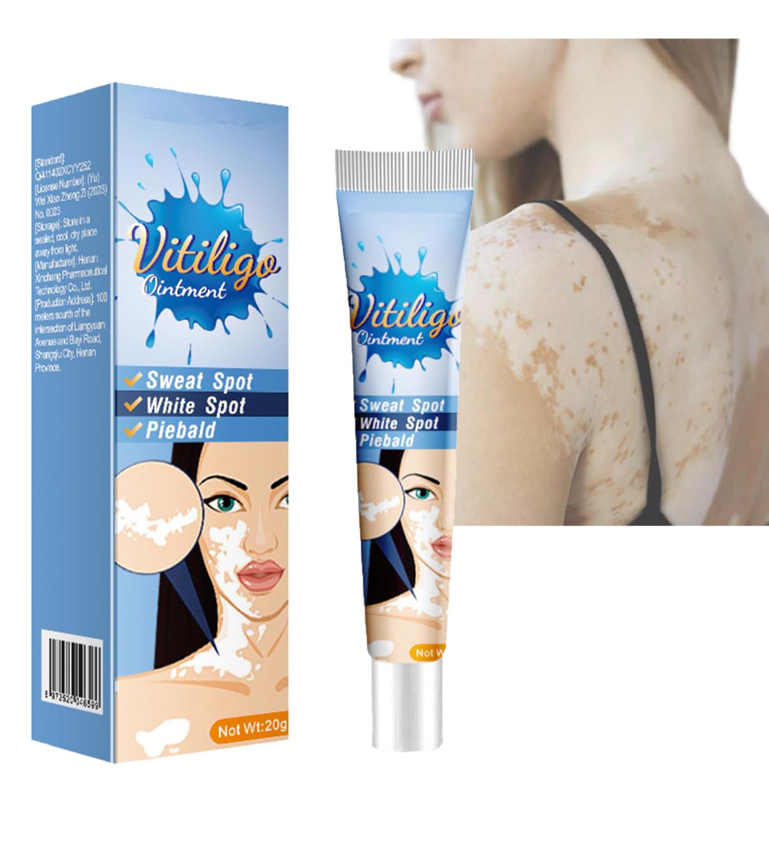 MIELIKKI Vitiligo Cream | Reduce White Spots & Enhance Skin Pigmentation | Natural Vitiligo Care Cream for All Skin Types - Buy Online on SooperMarket.com