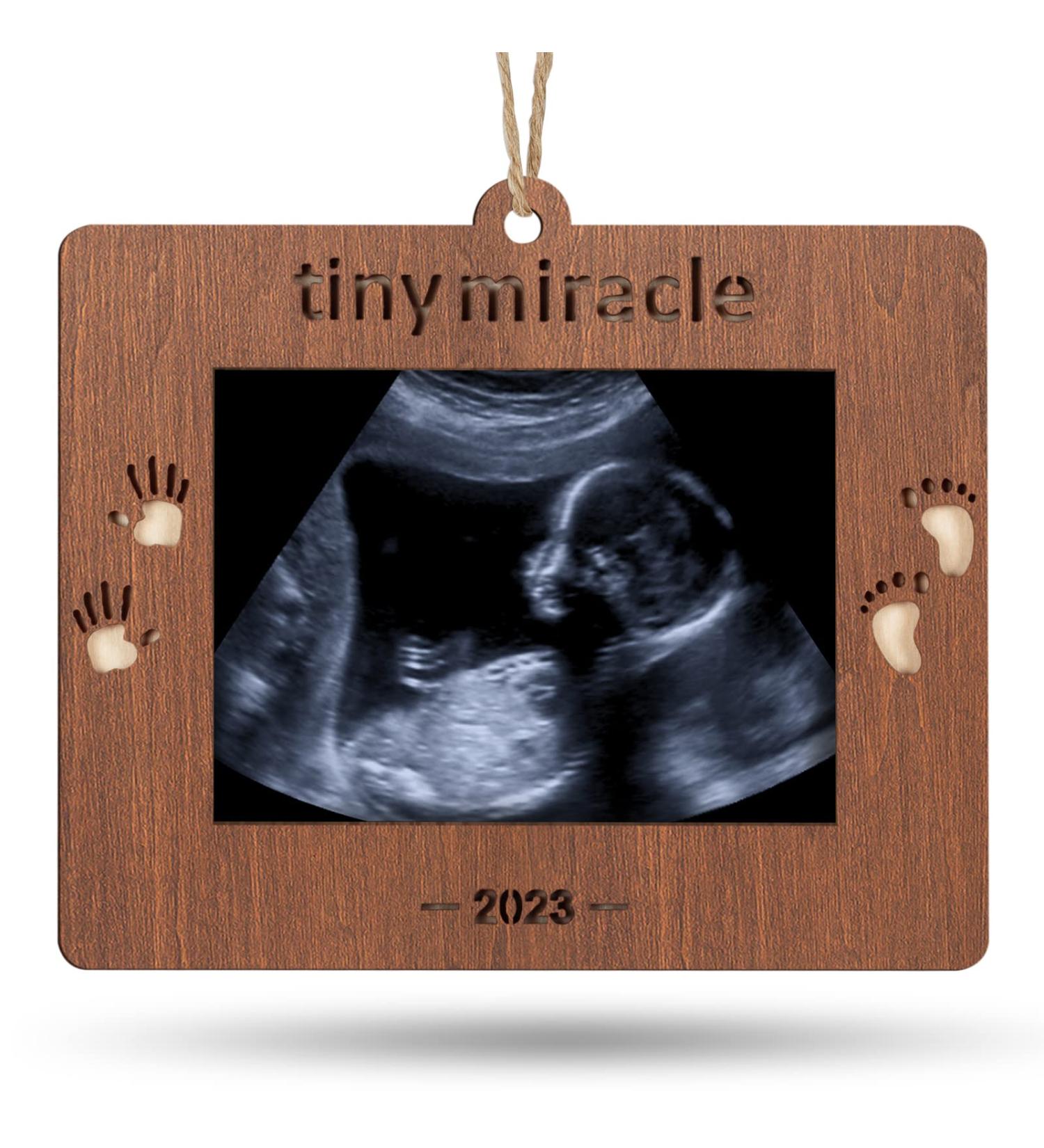 Creawoo 2023 Tiny Miracle Sonogram Picture Frame - Baby's First Christmas Gift for Expecting Parents and Grandparents - Buy Online on SooperMarket.com