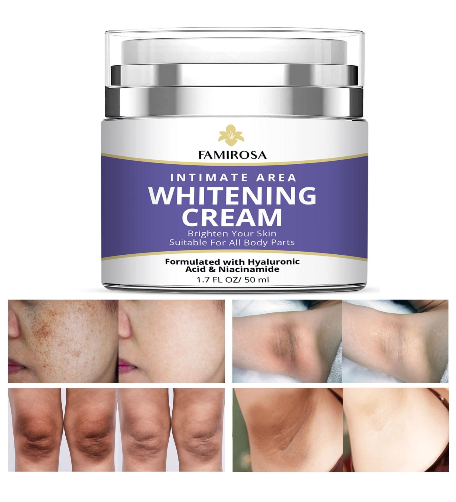 Intimate Area Dark Spot Corrector - Underarm, Knees, Elbows, Thighs, Private Parts Cream - Buy Online on SooperMarket.com