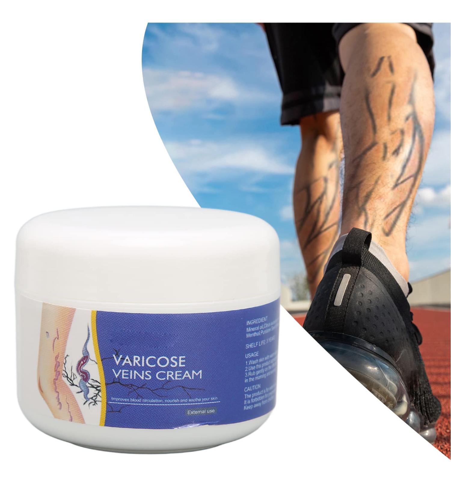50g Natural Varicose Veins Cream | Leg Circulation & Spider Vein Remover | Cooling Effect | Ointment - Buy Online on SooperMarket.com