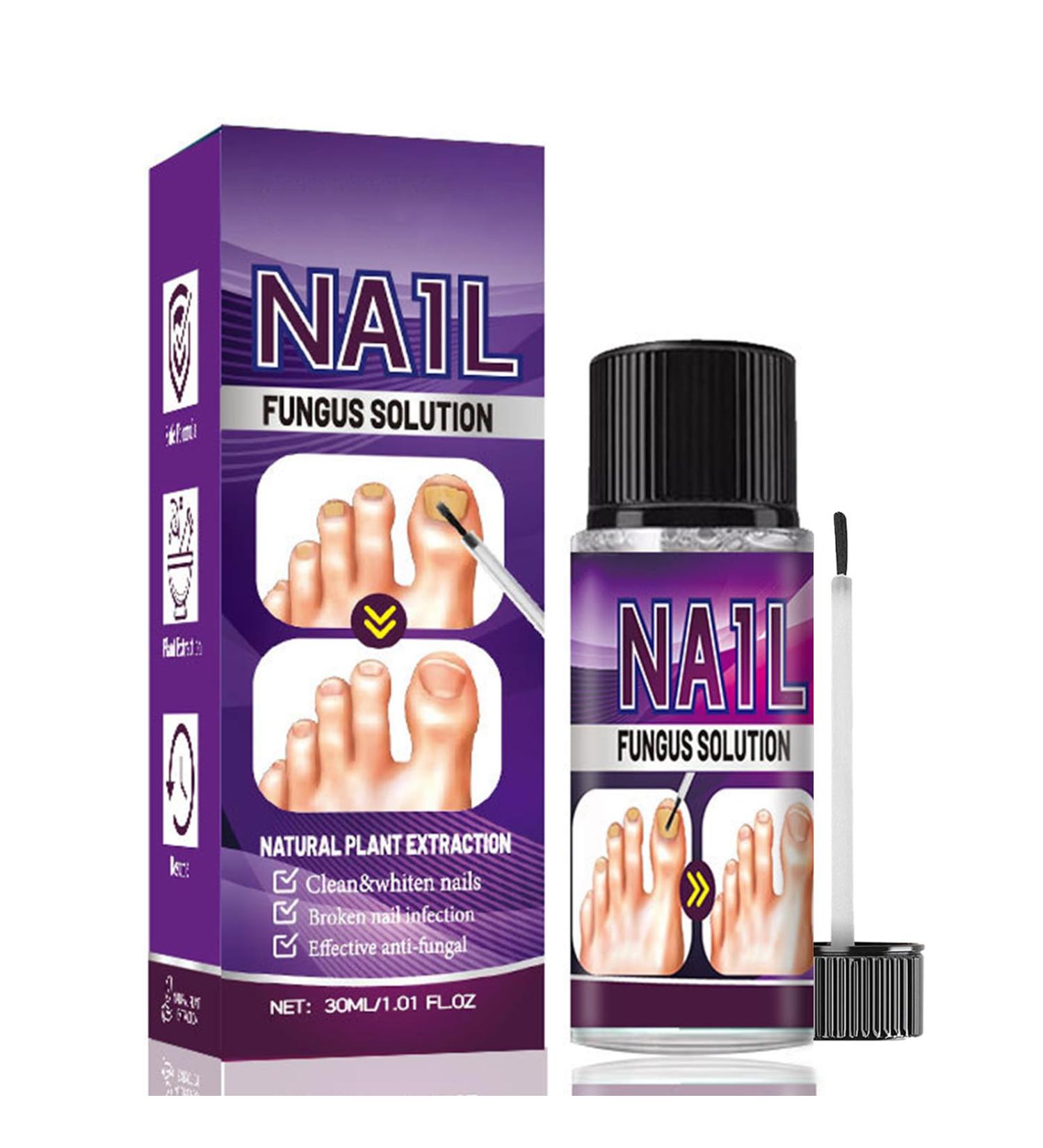 Fungal Nail Treatment 30ml Extra Strong Nail Fungus Treatment for Toenail and Fingernail Premium Fungal Nail Eliminator Anti fungus Nail Repair and Strengthen Fix & Renew Damaged Broken Nails - Buy Online on SooperMarket.com
