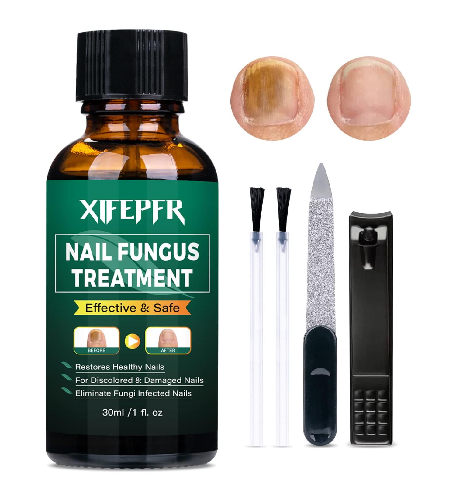 XIFEPFR Toenail Repair Treatment - Extra Strength Nail Renewal Solution for Thick, Brittle, and Discolored Nails - Buy Online on SooperMarket.com