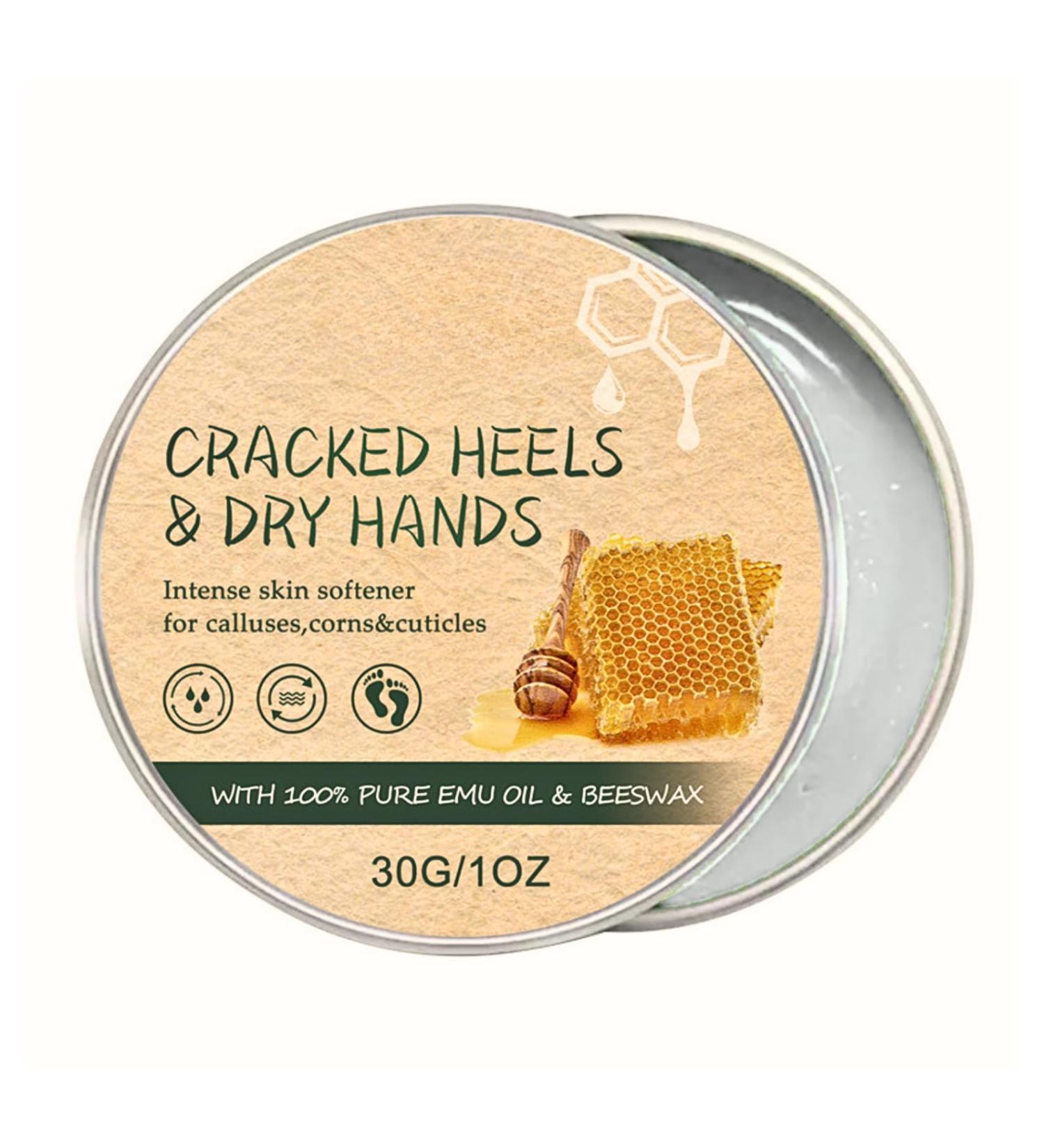 Foot Cream for Cracked Heels and Dry Skin Feet Hard Skin Remover Foot Moisturiser Callus Remover for Feet Nourishes Feet & Hand Foot Care Cream to Improve Elasticity & Smoothen Skin - Buy Online on SooperMarket.com