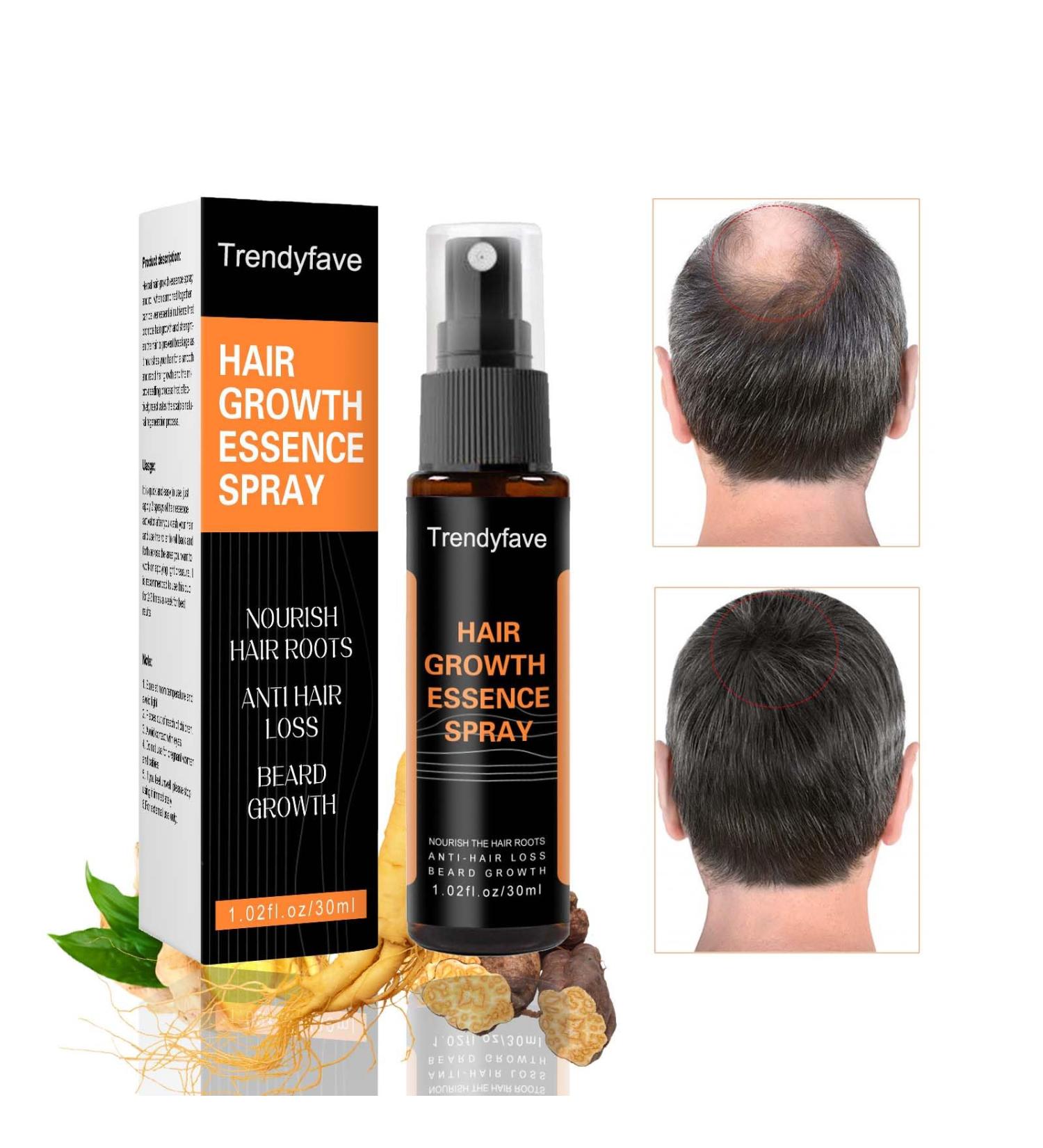 Trendyfave Hair Regrowth Spray Hair Growth Serum Thickening Hair Volume Spray Anti Hair Loss Spray Hair Rapid Growth Spray Natural Ingredients Hair Regrowth Serum Repair Hair Follicles -30ML - Buy Online on SooperMarket.com