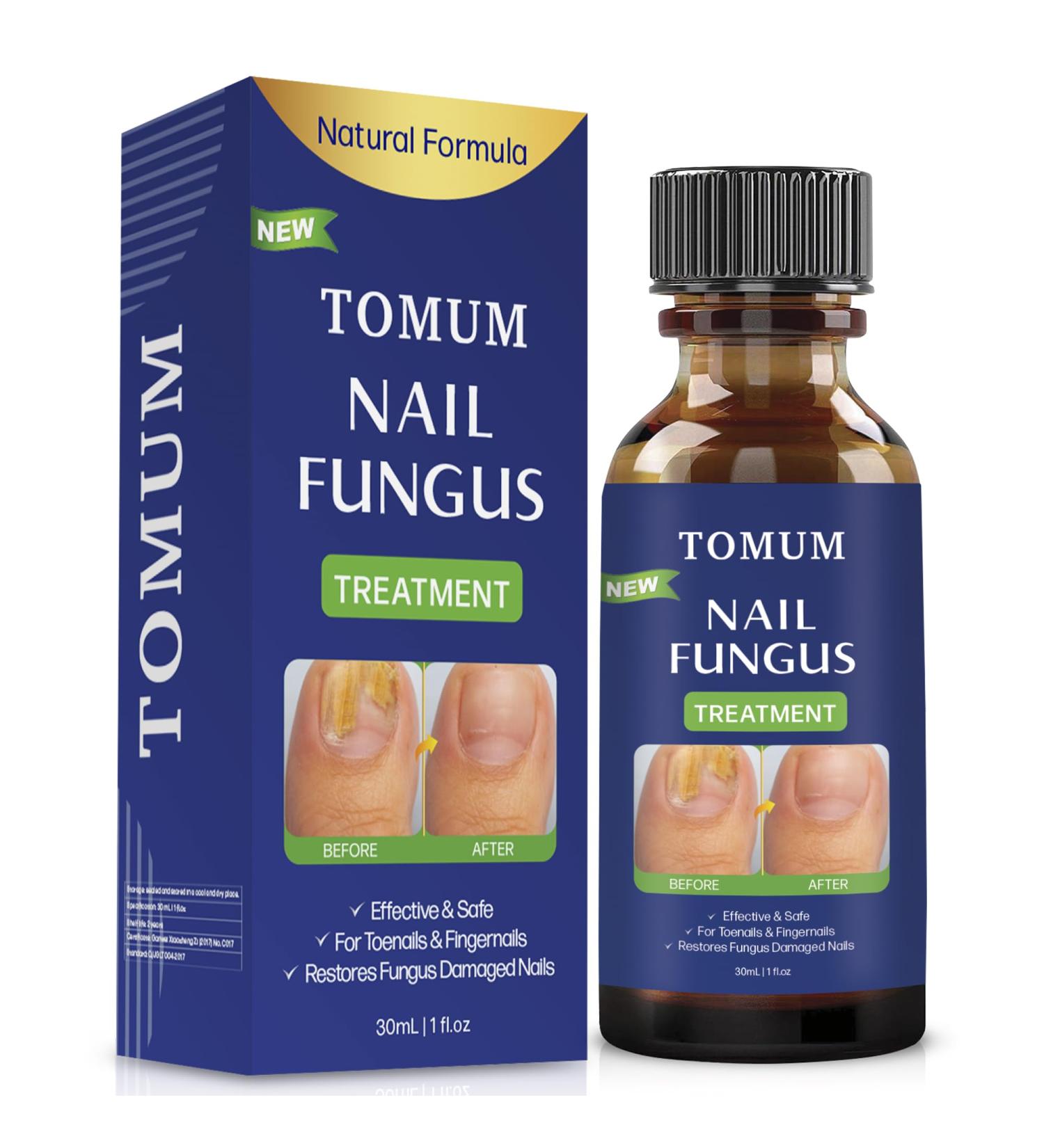 Extra Strength Toe Nail Fungus Treatment for Healthy Nails - Fingernail and Toenail Repair Solution - Buy Online on SooperMarket.com