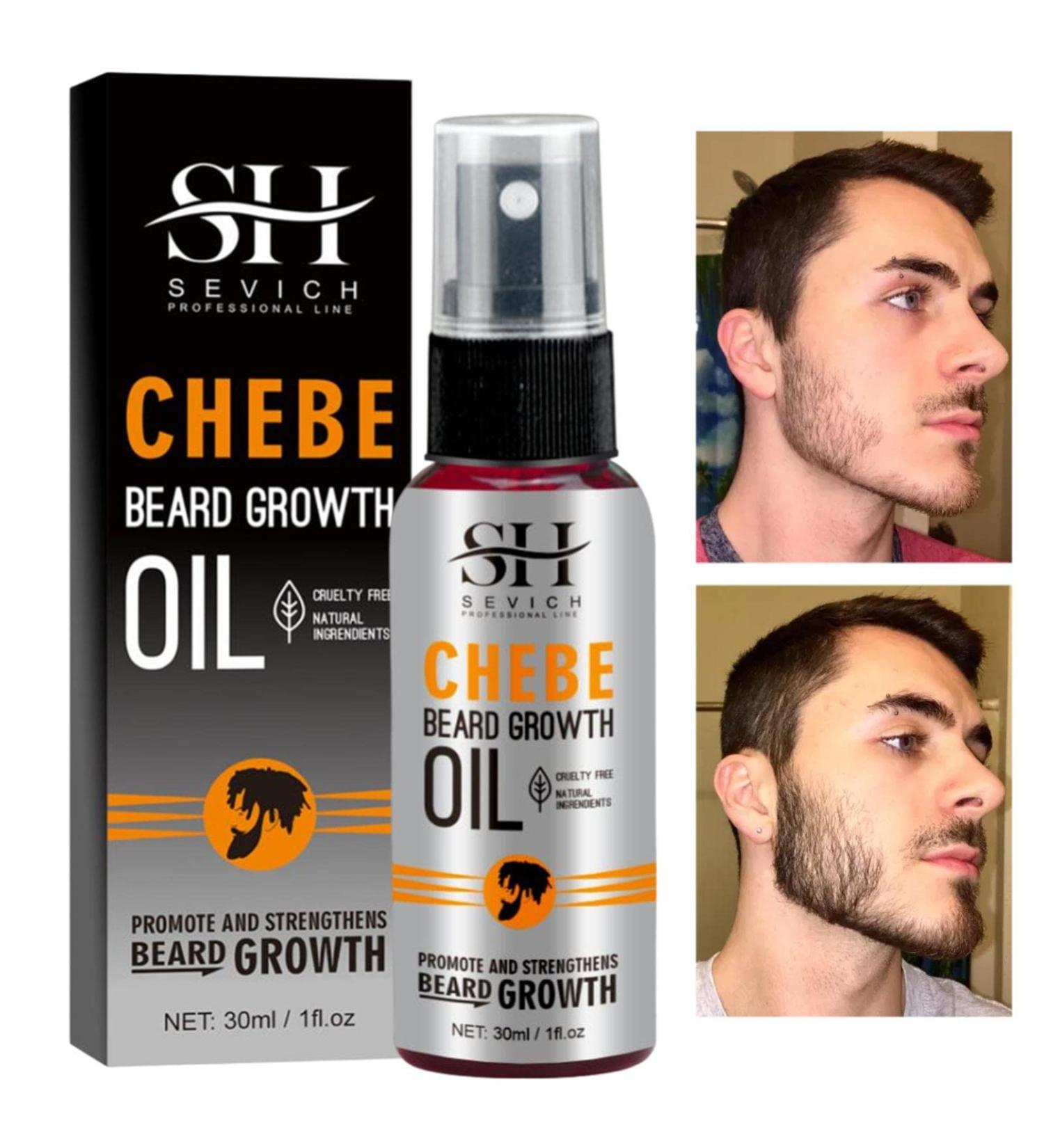 Buy Visiblurry Beard Oil - Moisturizing & Nourishing 1 fl. OZ for Fuller Beard Growth | International Shipping Available - Buy Online on SooperMarket.com