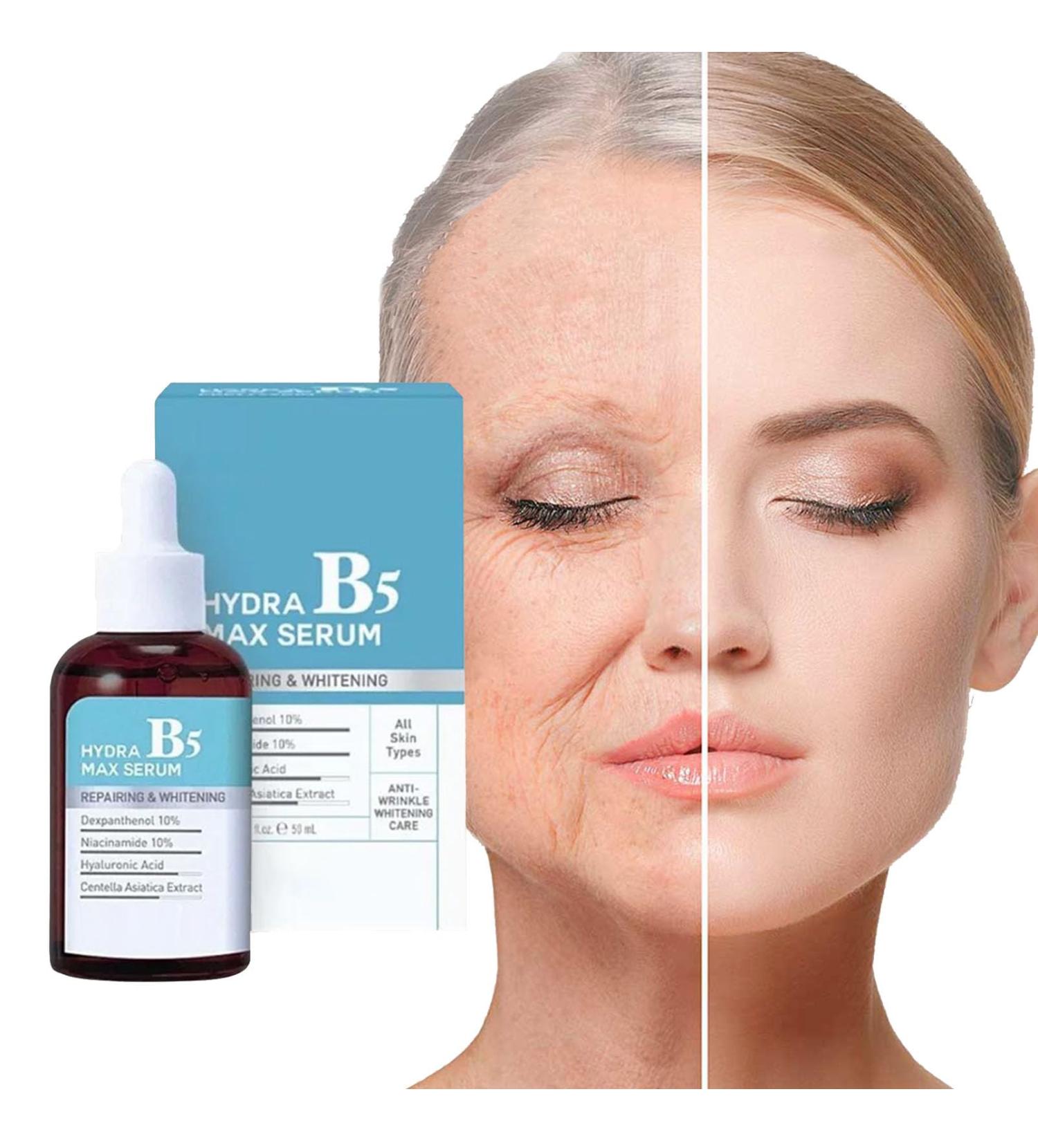Nmbol Skin Lightening Serum B5 Spot Correction Serum B5 Corrector Serum Pigment Spot Remover Serum B5 Against Pigment Spots Wrinkle Reduction and Adolescent Radiation - Buy Online on SooperMarket.com