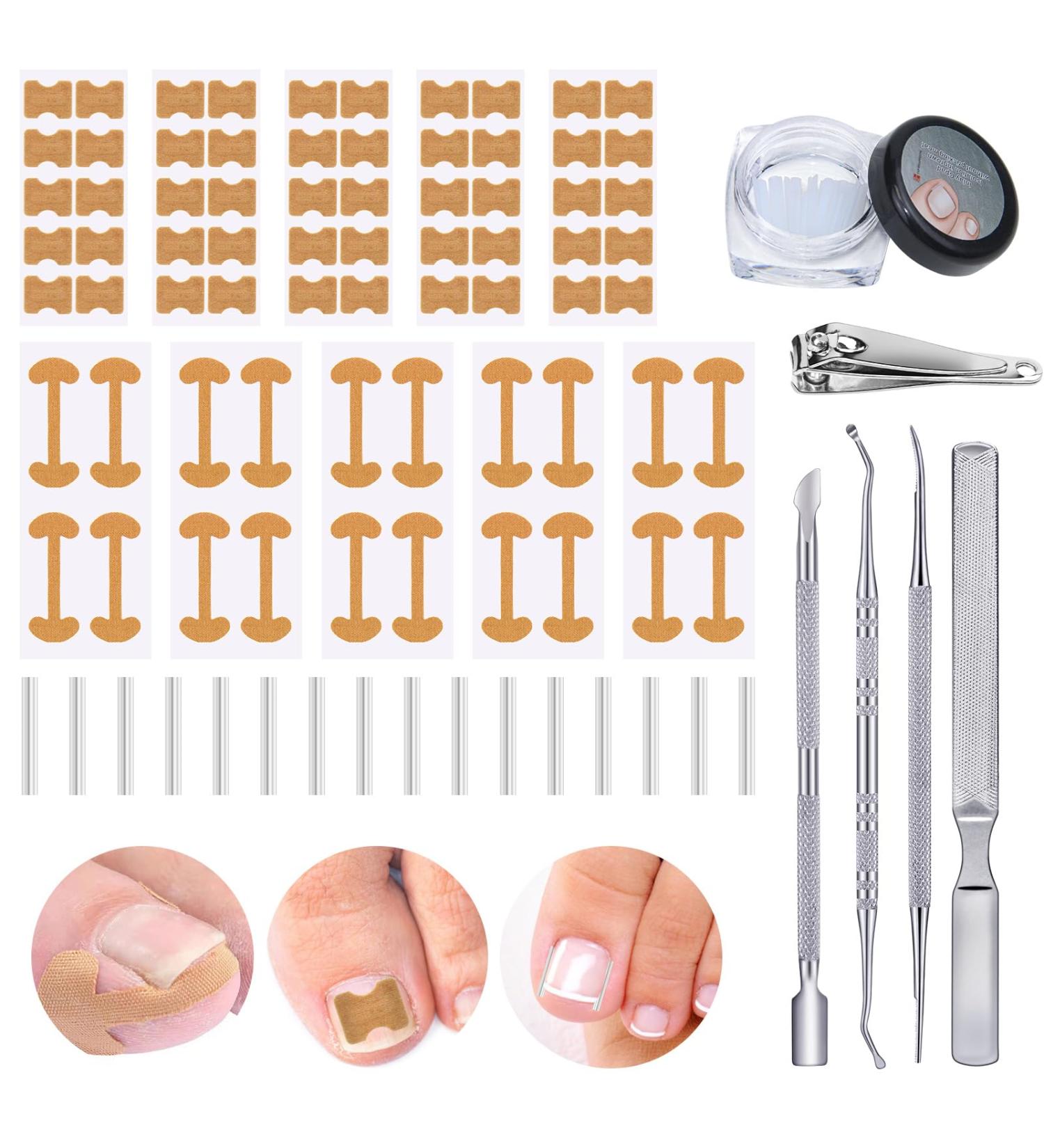 105-Piece Ingrown Toenail Tool Set | Complete Pedicure Kit with Correction Stickers Nail Tongs & Files for Perfect Toenail Care - Buy Online on SooperMarket.com