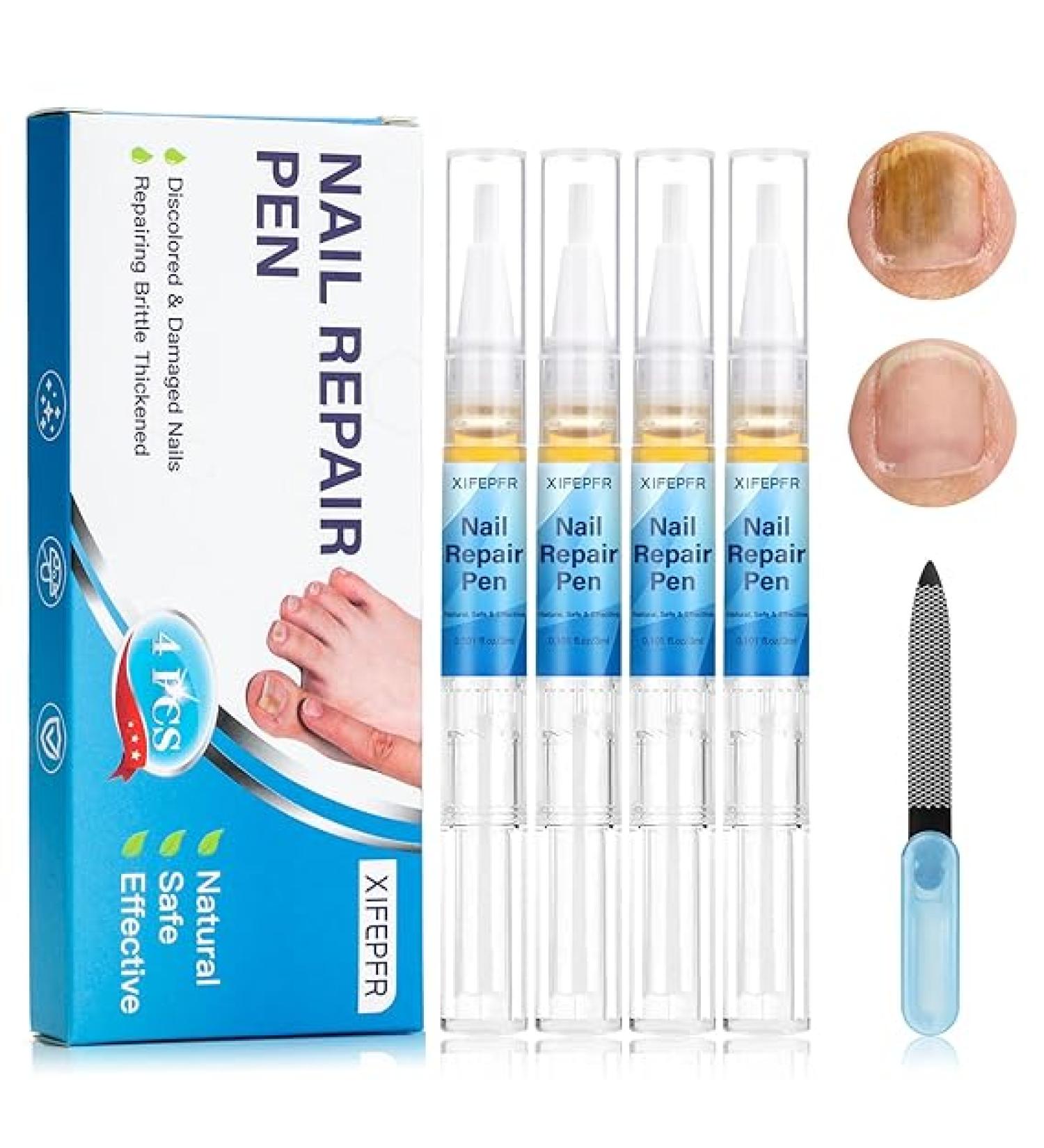 XIFEPFR Toenail Repair Pen - Nail Fingernail Repair Pen for Thick  Broken  Discolored Nails - Restores Healthy Strong Nails - 4PCS - Buy Online on SooperMarket.com