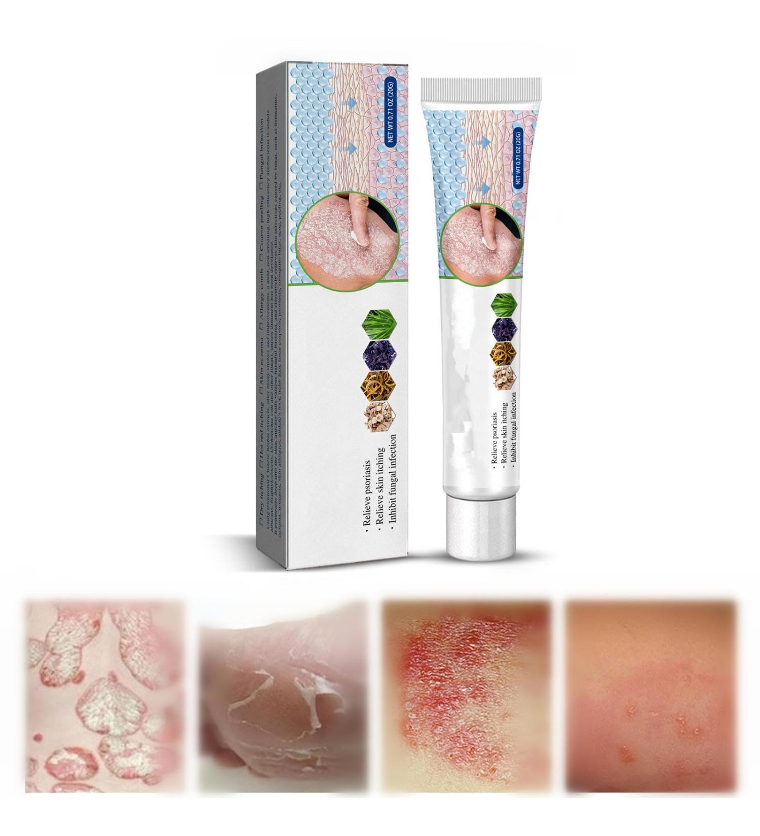 Face Cream Body Cream Anti-Itch Cream Chinese Herbal Cream Skin Repairing Cream for Face Body Cream for Itchy Skin Moisturizing Skin Cream 20 g - Buy Online on SooperMarket.com