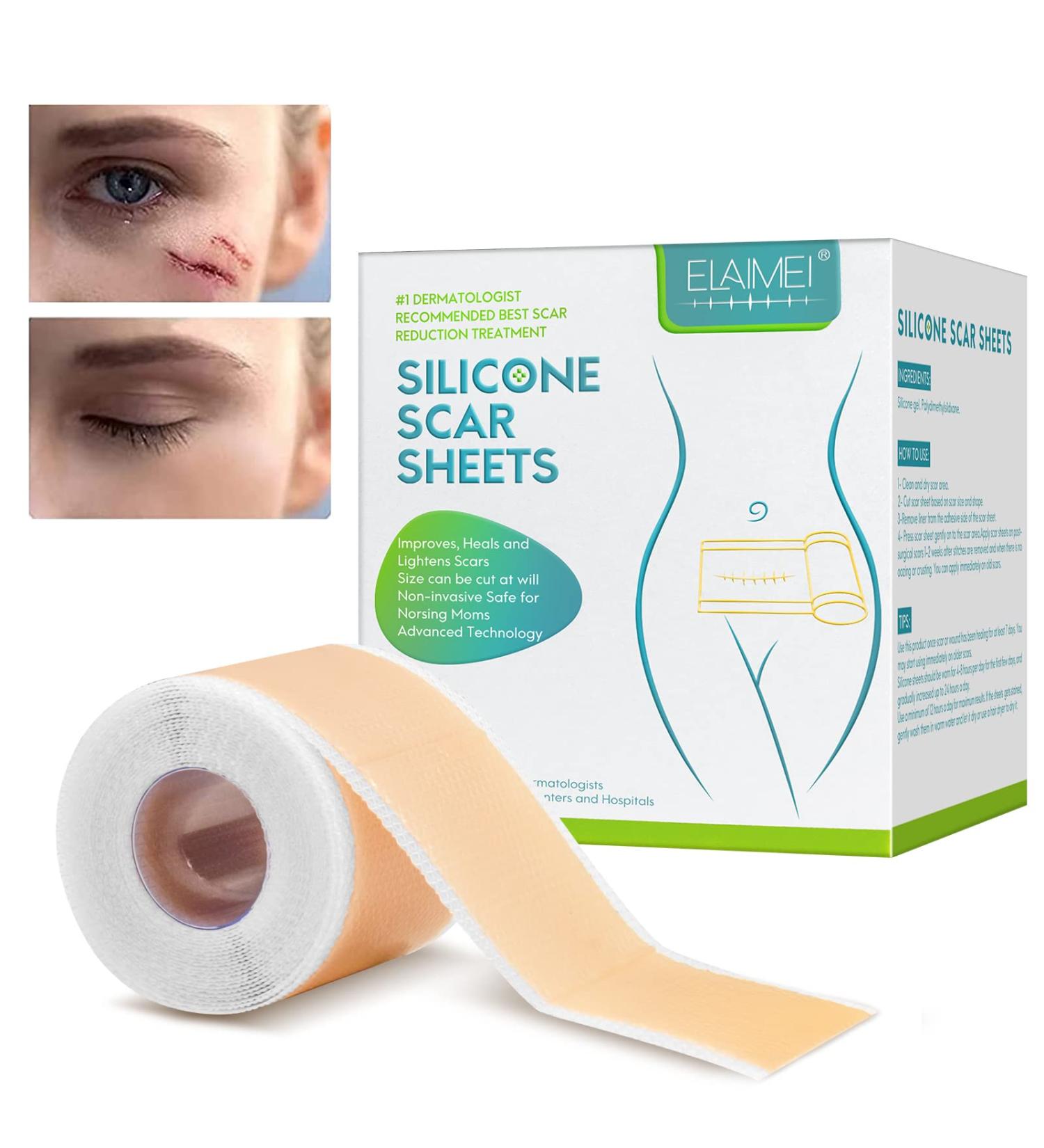 Medical Grade Silicone Scar Tape Roll (1.6 x 60) for Scar Removal - Professional Silicone Strips for Surgery, C-Section, Acne, Burn and Keloid - Safe & Reusable - 1.5M - Buy Online on SooperMarket.com