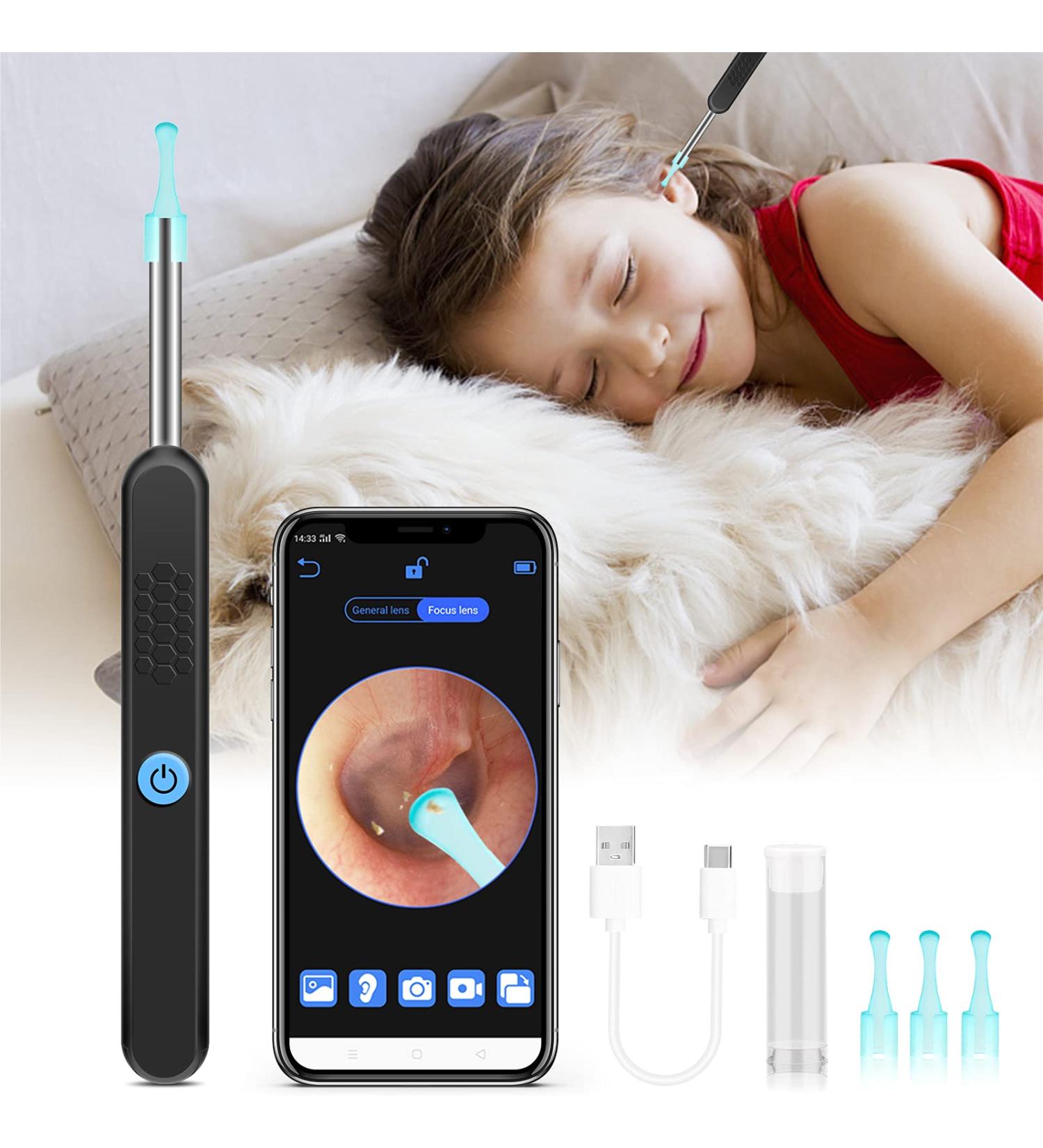 Smart Wireless Ear Wax Removal Tool Camera | Visual Ear Cleaner Kit for Babies, Kids, Adults, Pets | 1296P Ear Otoscope Scope with Cleaning Tool - Buy Online on SooperMarket.com