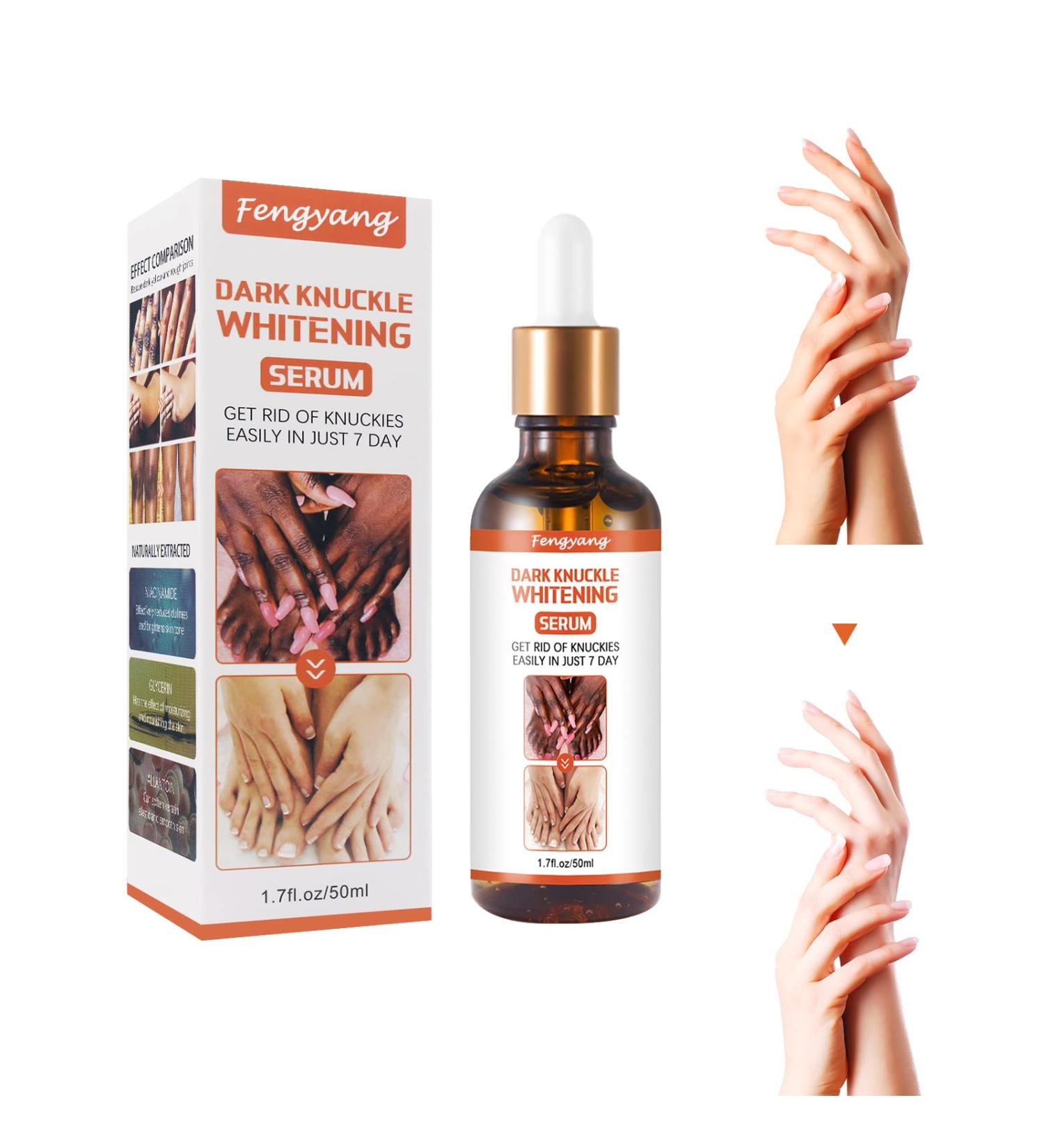 Fengyang Skin Whitening Serum Dark Knuckle Whitening Cream Dark Knuckle Whitening Serum Dark Knuckle Whitening Lotion Removing Dark Ankle Fingers - Buy Online on SooperMarket.com