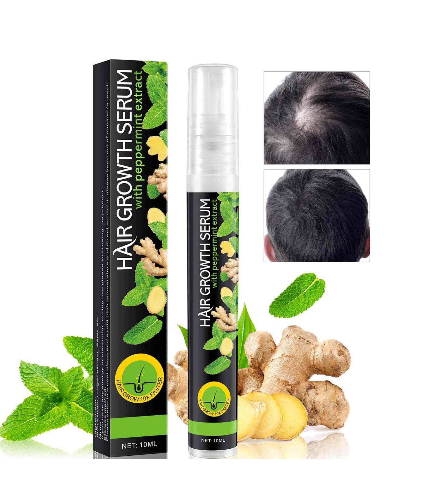 Hair Regrowth Spray Hair Growth Serum for Men & Women Anti Hair Loss Spray with Mint and Ginger Hair Rapid Growth Spray Repair Hair Follicles Hair Regrowth Serum for Bald Spots & Thinning Hair - Buy Online on SooperMarket.com