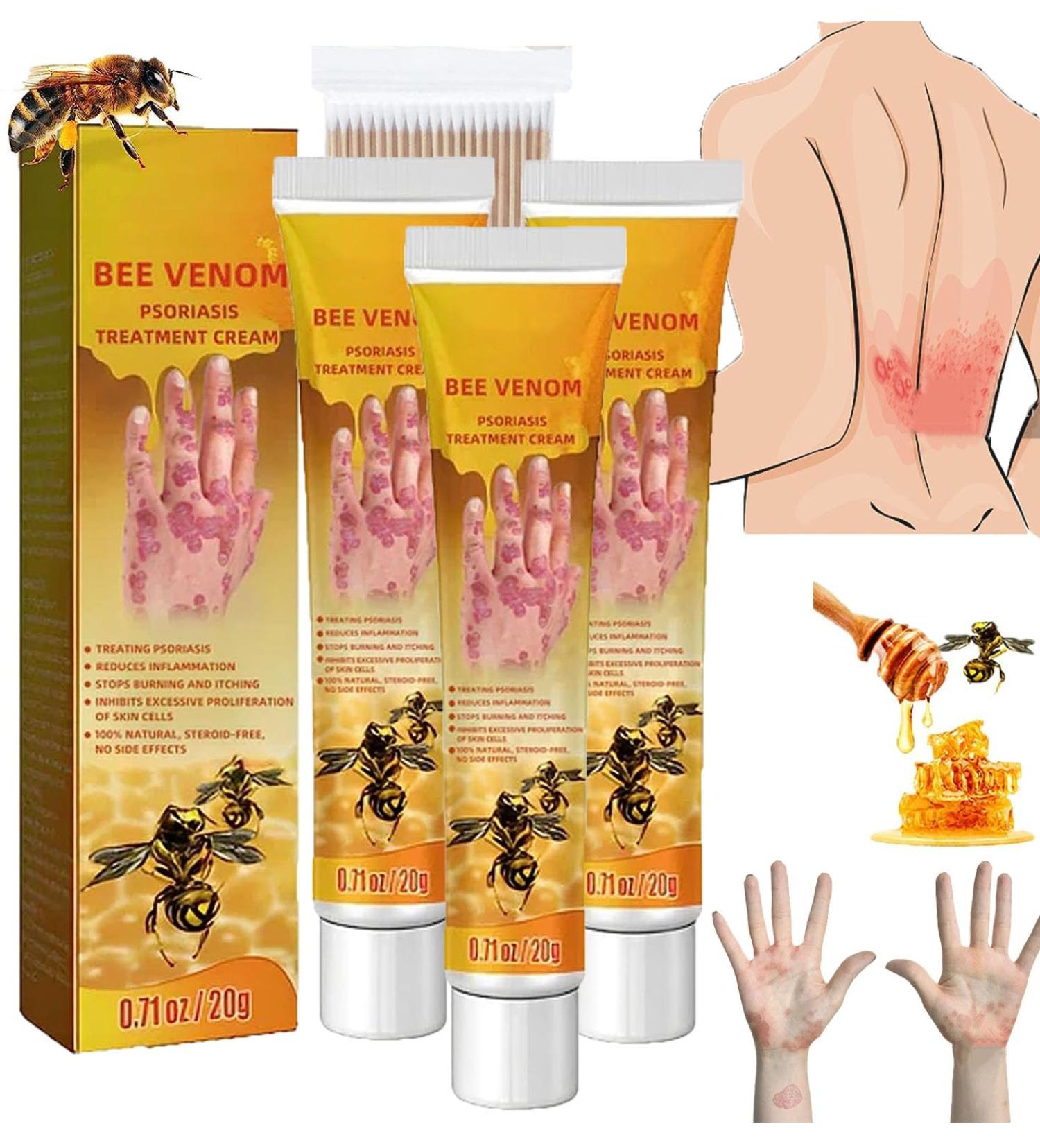 RJDJ Bee Venom Psoriasis Treatment Cream New Zealand Bee Venom Professional Psoriasis Treatment Cream Soothing and Moisturizing Psoriasis Cream for All Skin Types (4PCS)