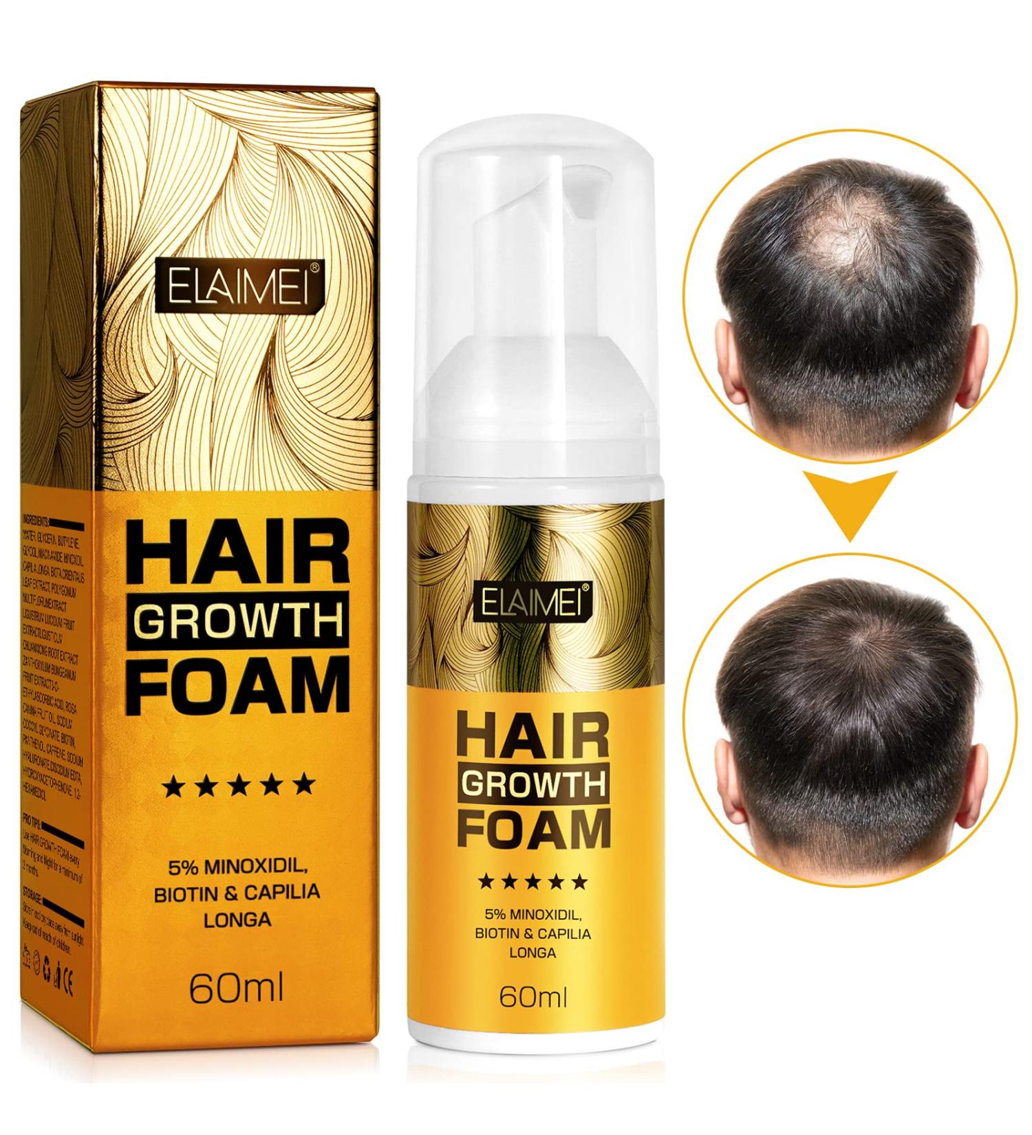 5% Minoxidil Foam Hair Regrowth Treatment for Men & Women - Stops Hair Loss, Promotes Follicle Growth - 2.11fl oz - Buy Online on SooperMarket.com