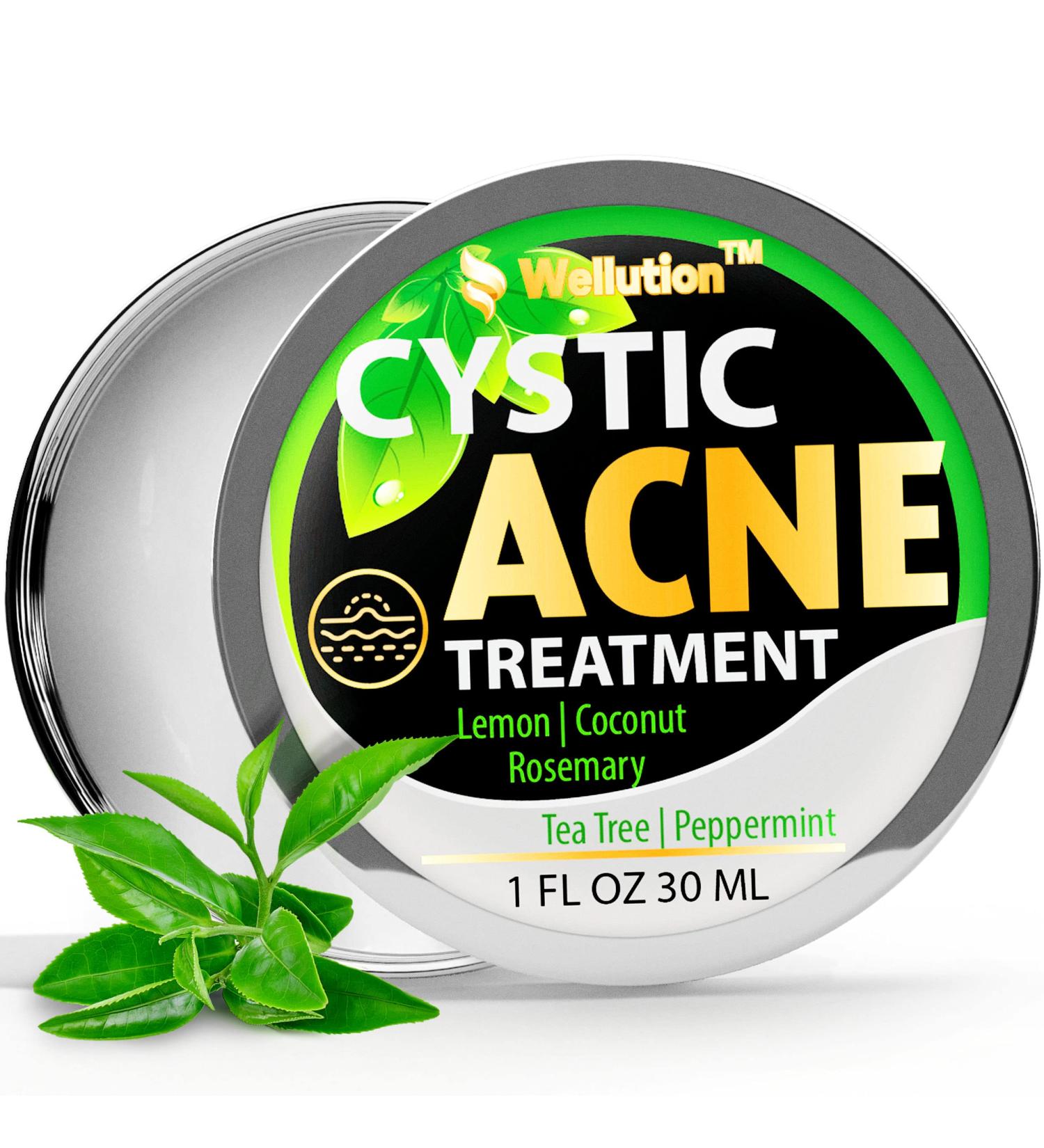 Cystic Acne Treatment & Scar Remover - USA Made Severe Acne Cleanser with Tea Tree Oil - Prevent Breakouts - Natural Pimple Cream - Buy Online on SooperMarket.com