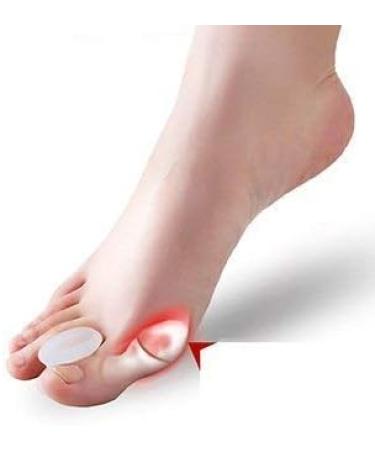 JHGCCL 2PCS Soft Gel Toe Corrector Pads for Hallux Valgus - Toe Straighteners and Protector for Bent Toes - Buy Online on SooperMarket.com
