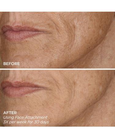 Discover BeautyBio GloPRO FACE MicroTip Attachment - Elevate Your Style Instantly! - Buy Online on SooperMarket.com
