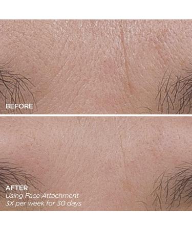 Discover BeautyBio GloPRO FACE MicroTip Attachment - Elevate Your Style Instantly! - Buy Online on SooperMarket.com