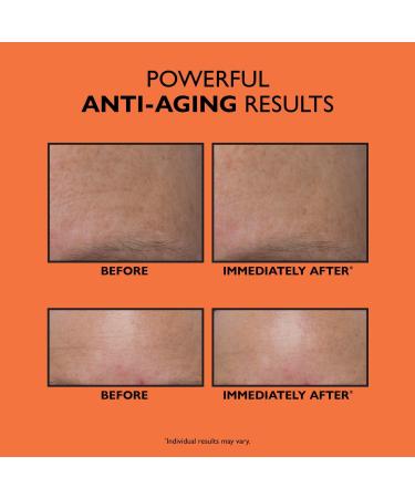 Peter Thomas Roth Anti-Aging Triple-Acid Peel 1.7 oz - Discover Premium Quality Shop now! - Buy Online on SooperMarket.com