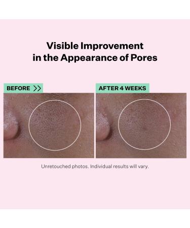 Discover StriVectin Multi-Action Super Shrink Pore Minimizing Serum 1.0 oz - Elevate Your Style Instantly! - Buy Online on SooperMarket.com