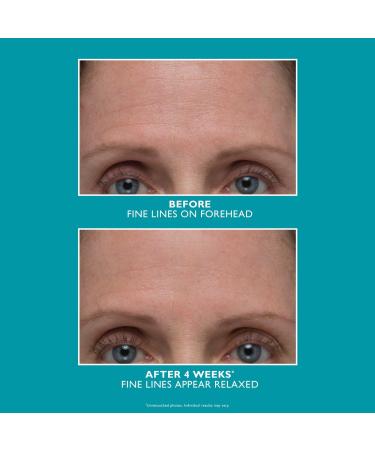 Discover Peter Thomas Roth Peptide Skinjection Amplified Wrinkle-Fix Serum 1.0 oz - Elevate Your Style Instantly! - Buy Online on SooperMarket.com