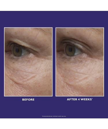Discover Peter Thomas Roth Ultimate Solution 5 Multitasking Eye Cream - Elevate Your Style Instantly! - Buy Online on SooperMarket.com
