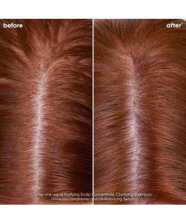 Discover Biolage Scalp Sync Clarifying Shampoo 33.8 oz - Elevate Your Style Instantly! - Buy Online on SooperMarket.com