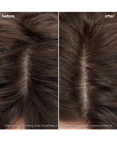 Biolage Scalp Sync Universal Conditioner 33.8 oz - Transform Your Style with the Best Innovation Today! - Buy Online on SooperMarket.com