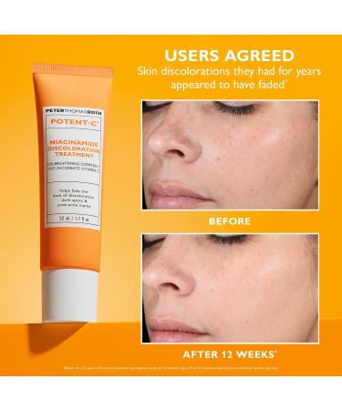 Discover Peter Thomas Roth Potent-C Niacinamide Discoloration Treatment - Elevate Your Style Instantly! - Buy Online on SooperMarket.com