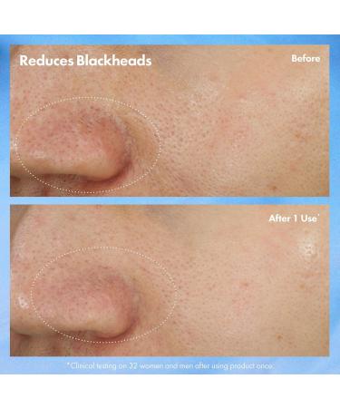 Discover Origins Clear Improvement Blackhead Clearing Mask-to-Scrub 2.5 oz - Elevate Your Style Instantly! - Buy Online on SooperMarket.com