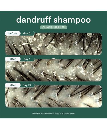 Verb Dandruff Shampoo with Salicylic Acid for Dry and Flaky Scalp 8.0 oz - Discover Premium Quality Shop now! - Buy Online on SooperMarket.com