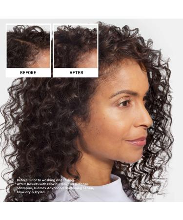 Discover Nioxin Hair Fall Defense Shampoo 33.8 oz - Elevate Your Style Instantly! - Buy Online on SooperMarket.com