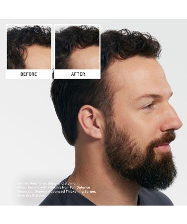Discover Nioxin Hair Fall Defense Shampoo 33.8 oz - Elevate Your Style Instantly! - Buy Online on SooperMarket.com