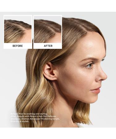 Discover Nioxin Hair Fall Defense Shampoo 33.8 oz - Elevate Your Style Instantly! - Buy Online on SooperMarket.com