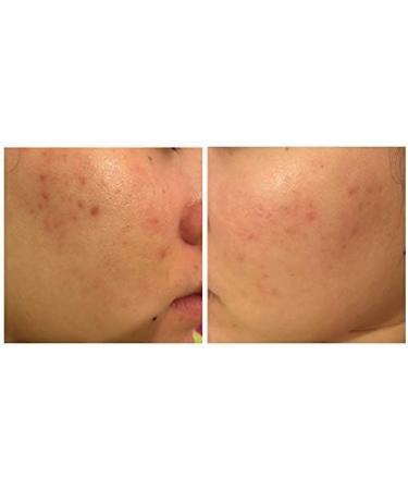 Avene Cicalfate Repair Cream Hypoallergenic for Sensitive & Irritated Skin 100 ml - Buy Online on SooperMarket.com
